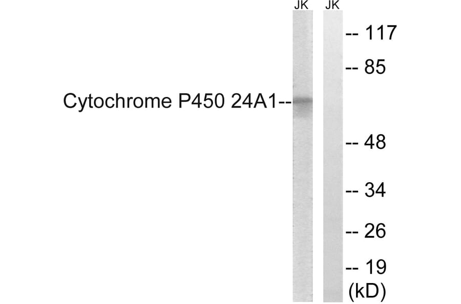 Western Blot - Anti-Cytochrome P450 24A1 Antibody (C12253) - Antibodies.com