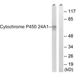 Western Blot - Anti-Cytochrome P450 24A1 Antibody (C12253) - Antibodies.com