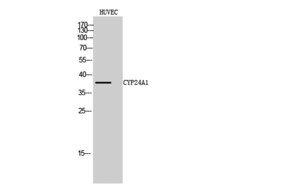 Western Blot - Anti-Cytochrome P450 24A1 Antibody (C12253) - Antibodies.com