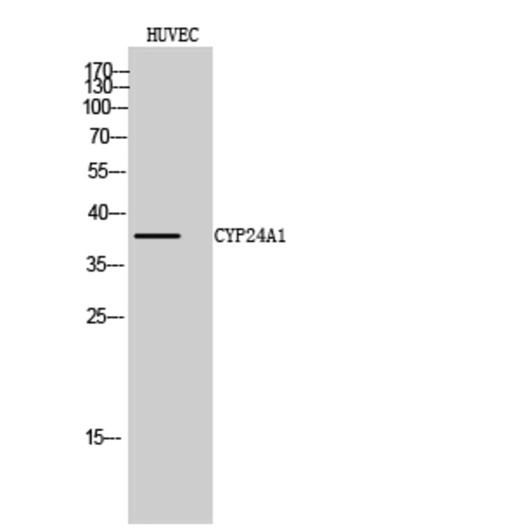 Western Blot - Anti-Cytochrome P450 24A1 Antibody (C12253) - Antibodies.com