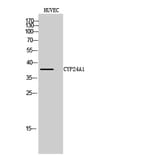 Western Blot - Anti-Cytochrome P450 24A1 Antibody (C12253) - Antibodies.com