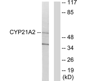 Western Blot - Anti-Cytochrome P450 21A2 Antibody (C12252) - Antibodies.com