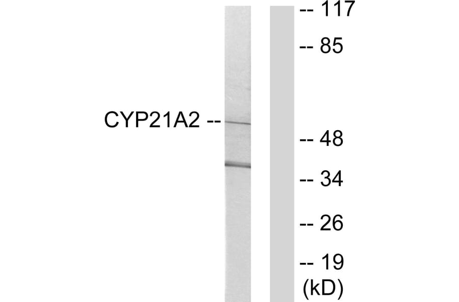 Western Blot - Anti-Cytochrome P450 21A2 Antibody (C12252) - Antibodies.com