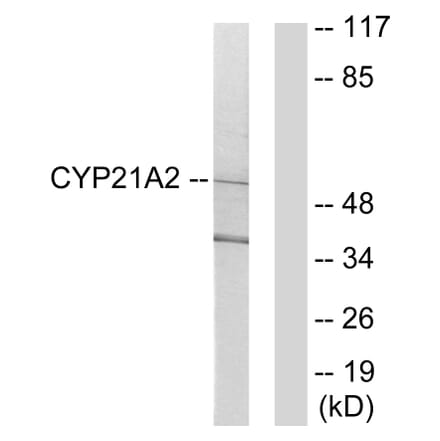 Western Blot - Anti-Cytochrome P450 21A2 Antibody (C12252) - Antibodies.com