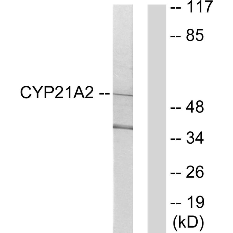 Western Blot - Anti-Cytochrome P450 21A2 Antibody (C12252) - Antibodies.com