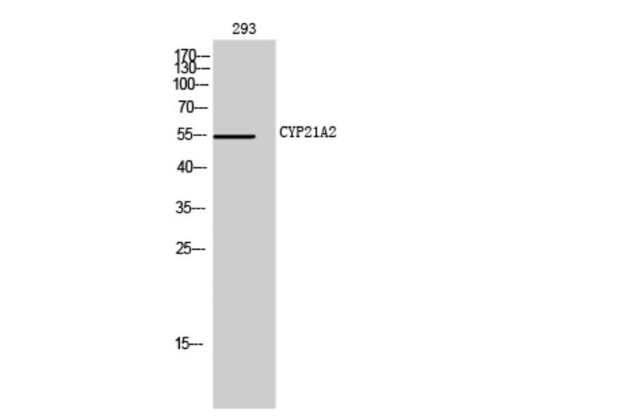 Western Blot - Anti-Cytochrome P450 21A2 Antibody (C12252) - Antibodies.com