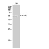 Western Blot - Anti-Cytochrome P450 21A2 Antibody (C12252) - Antibodies.com