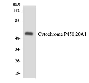 Western Blot - Anti-Cytochrome P450 20A1 Antibody (R12-2673) - Antibodies.com