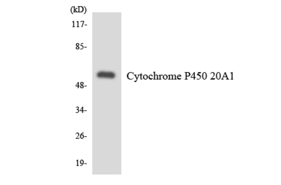 Western Blot - Anti-Cytochrome P450 20A1 Antibody (R12-2673) - Antibodies.com