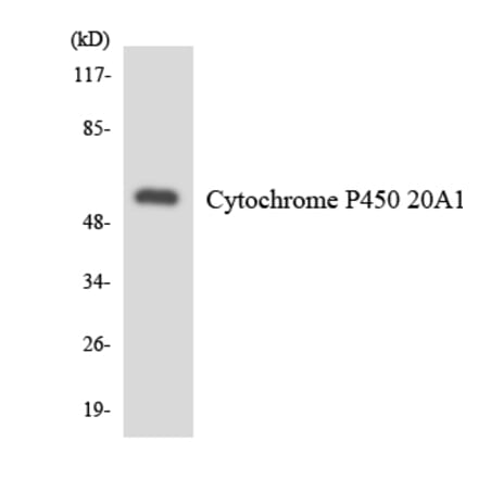 Western Blot - Anti-Cytochrome P450 20A1 Antibody (R12-2673) - Antibodies.com