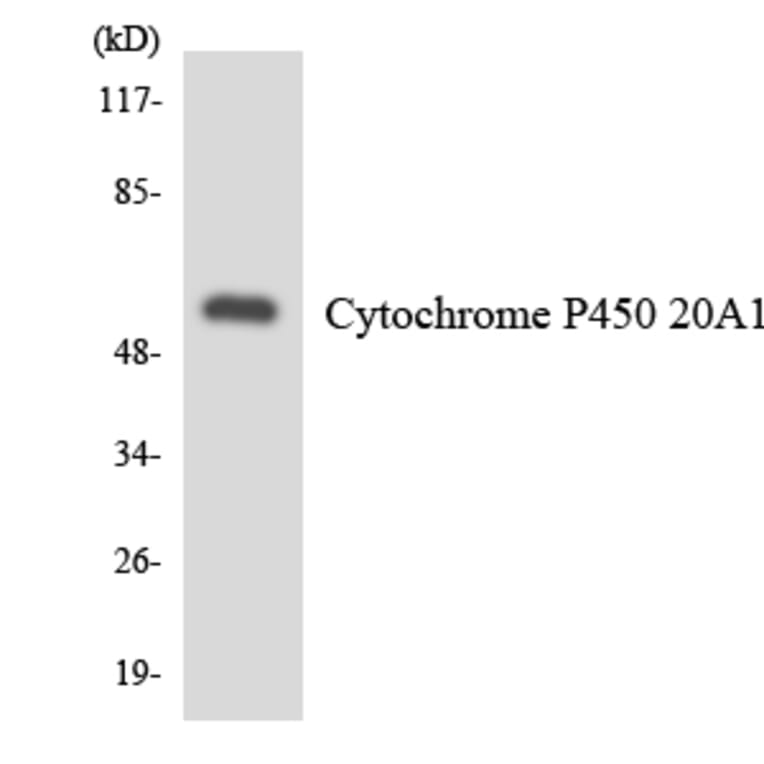Western Blot - Anti-Cytochrome P450 20A1 Antibody (R12-2673) - Antibodies.com
