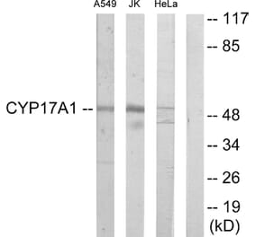 Western Blot - Anti-Cytochrome P450 17A1 Antibody (C12247) - Antibodies.com