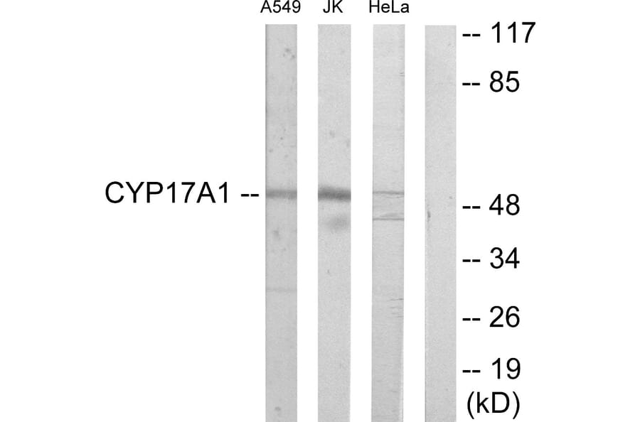 Western Blot - Anti-Cytochrome P450 17A1 Antibody (C12247) - Antibodies.com
