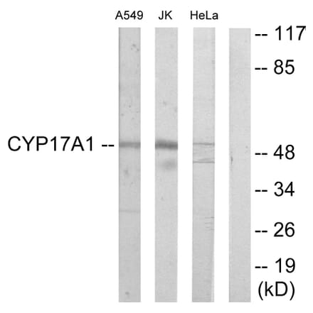 Western Blot - Anti-Cytochrome P450 17A1 Antibody (C12247) - Antibodies.com