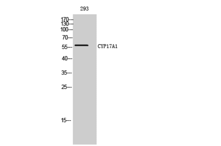 Western Blot - Anti-Cytochrome P450 17A1 Antibody (C12247) - Antibodies.com