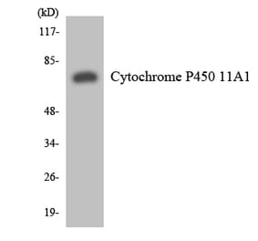 Western Blot - Anti-Cytochrome P450 11A1 Antibody (R12-2671) - Antibodies.com