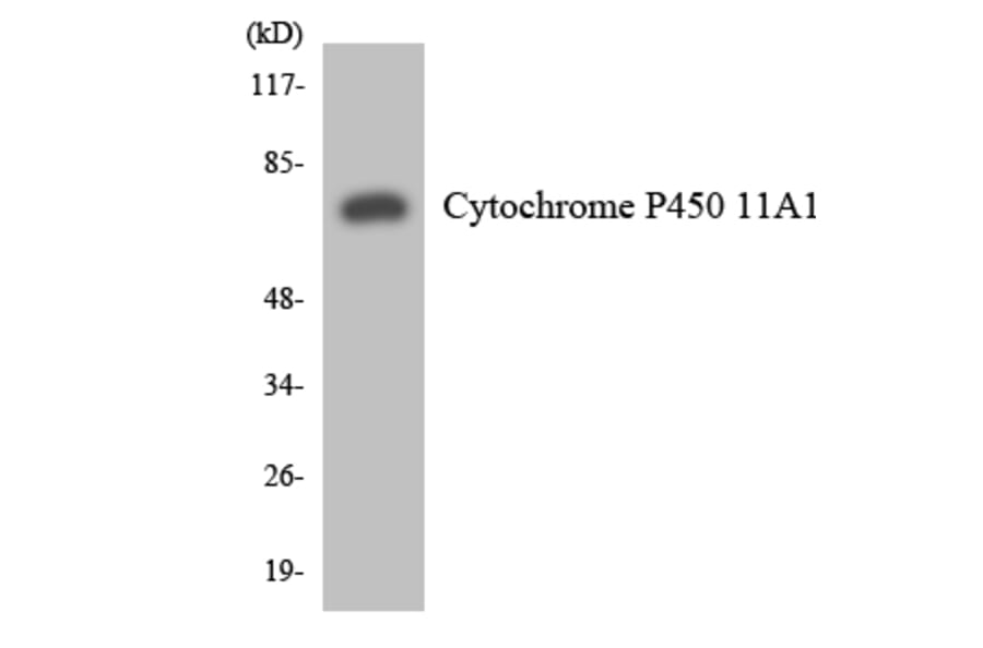Western Blot - Anti-Cytochrome P450 11A1 Antibody (R12-2671) - Antibodies.com