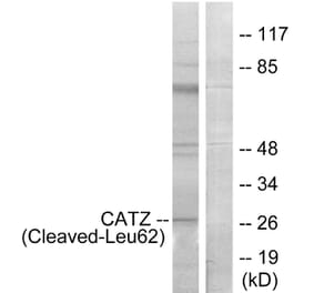 Western Blot - Anti-CATZ (cleaved Leu62) Antibody (L0189) - Antibodies.com