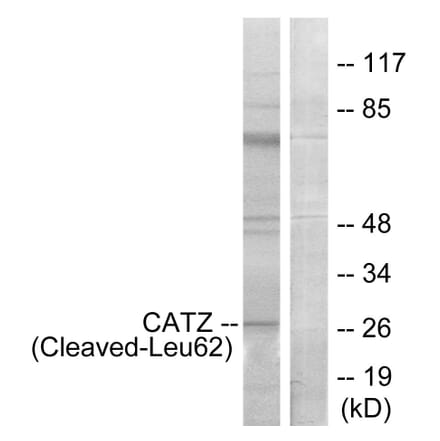 Western Blot - Anti-CATZ (cleaved Leu62) Antibody (L0189) - Antibodies.com