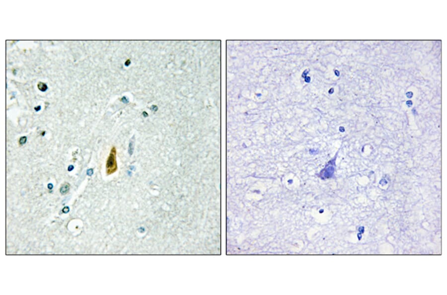 Immunohistochemistry - Anti-p53 (phospho Thr81) Antibody (A0699) - Antibodies.com