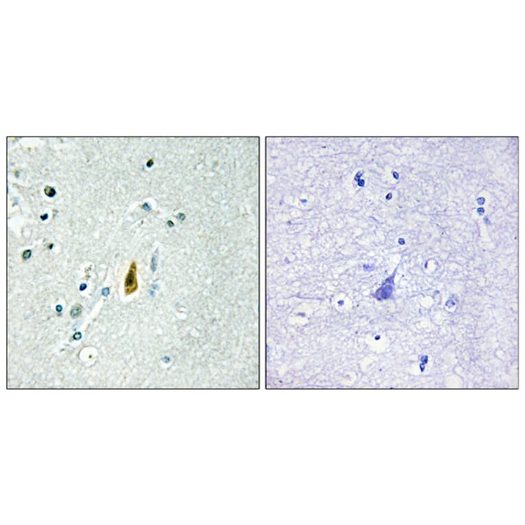 Immunohistochemistry - Anti-p53 (phospho Thr81) Antibody (A0699) - Antibodies.com