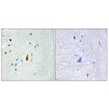 Immunohistochemistry - Anti-p53 (phospho Thr81) Antibody (A0699) - Antibodies.com