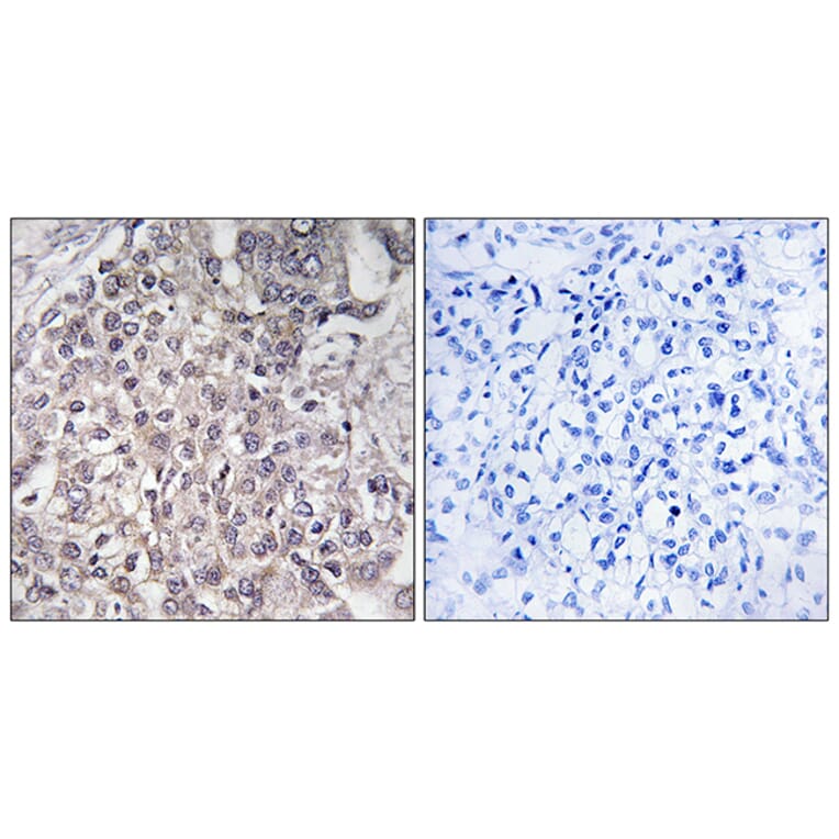 Immunohistochemistry - Anti-Cytochrome P450 4F2 Antibody (C12283) - Antibodies.com