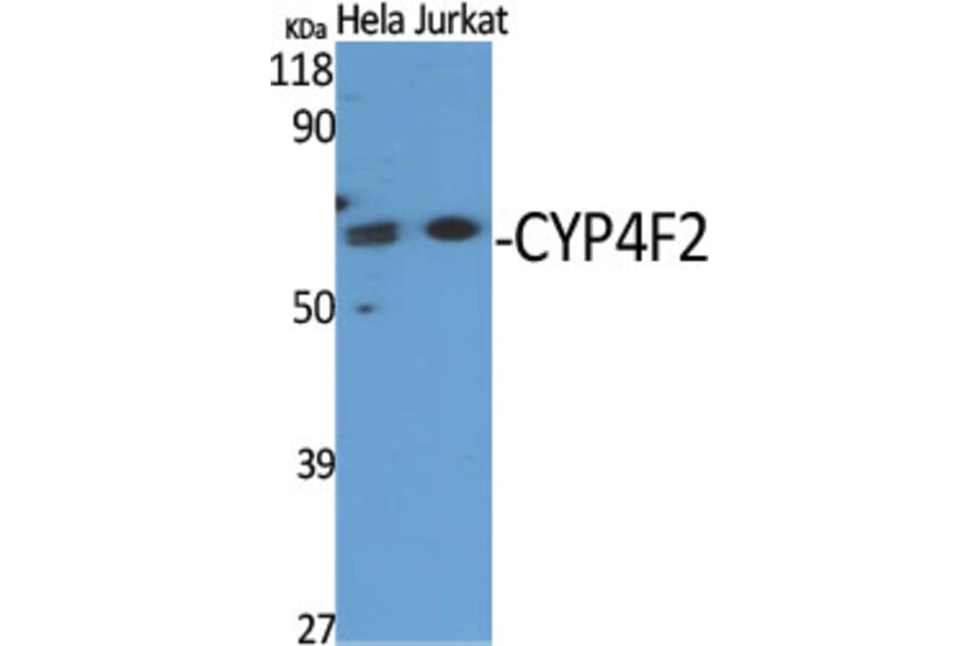 Western Blot - Anti-Cytochrome P450 4F2 Antibody (C12283) - Antibodies.com