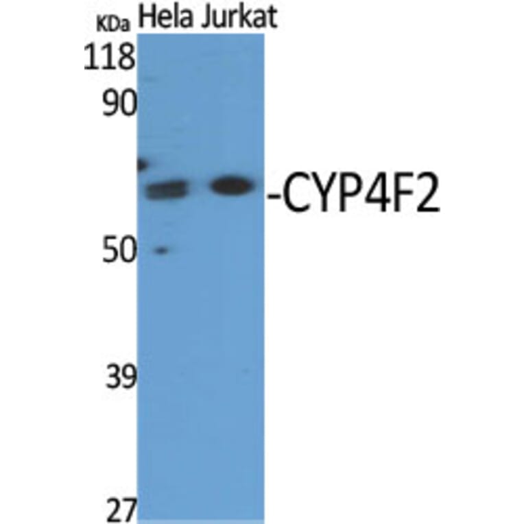 Western Blot - Anti-Cytochrome P450 4F2 Antibody (C12283) - Antibodies.com