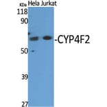 Western Blot - Anti-Cytochrome P450 4F2 Antibody (C12283) - Antibodies.com