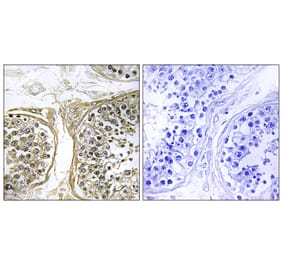 Immunohistochemistry - Anti-Cytochrome P450 2C8 Antibody (C12262) - Antibodies.com