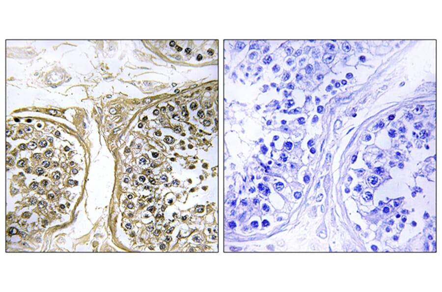 Immunohistochemistry - Anti-Cytochrome P450 2C8 Antibody (C12262) - Antibodies.com