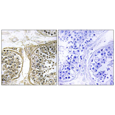 Immunohistochemistry - Anti-Cytochrome P450 2C8 Antibody (C12262) - Antibodies.com