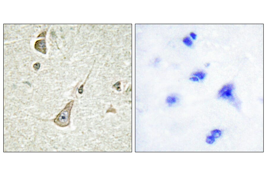 Immunohistochemistry - Anti-PCDH X + PCDH Y Antibody (C11648) - Antibodies.com