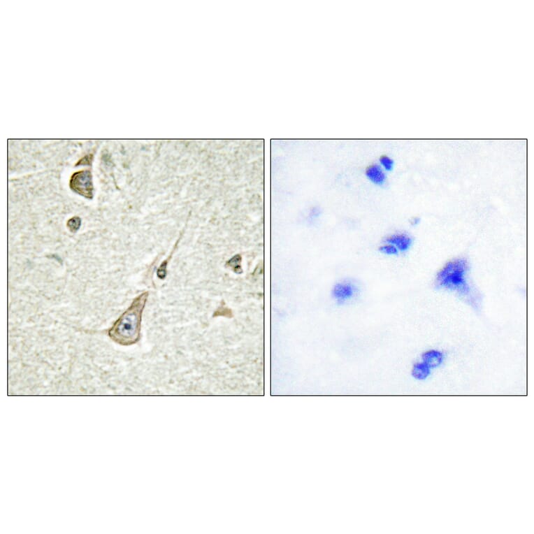 Immunohistochemistry - Anti-PCDH X + PCDH Y Antibody (C11648) - Antibodies.com