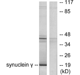 Western Blot - Anti-Synuclein gamma Antibody (C0334) - Antibodies.com