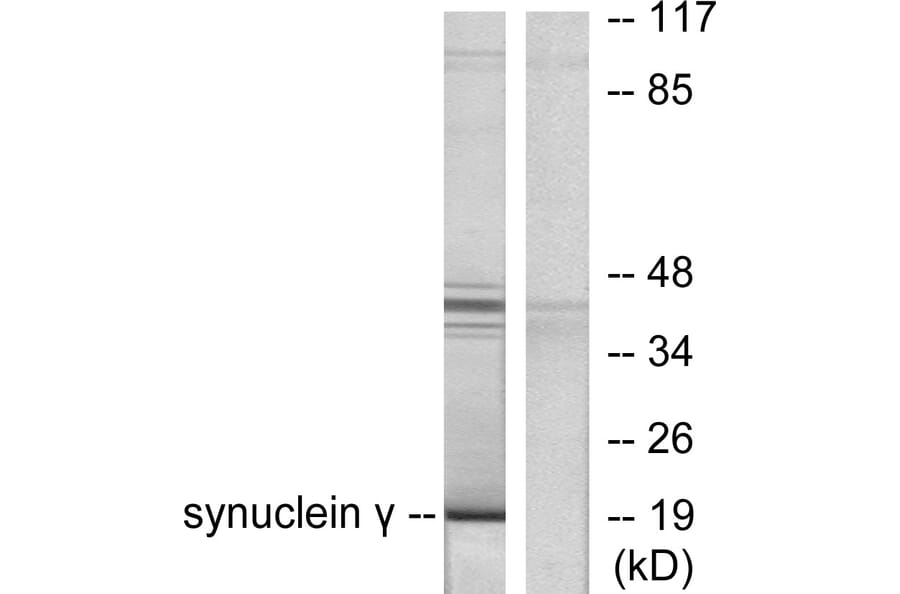 Western Blot - Anti-Synuclein gamma Antibody (C0334) - Antibodies.com
