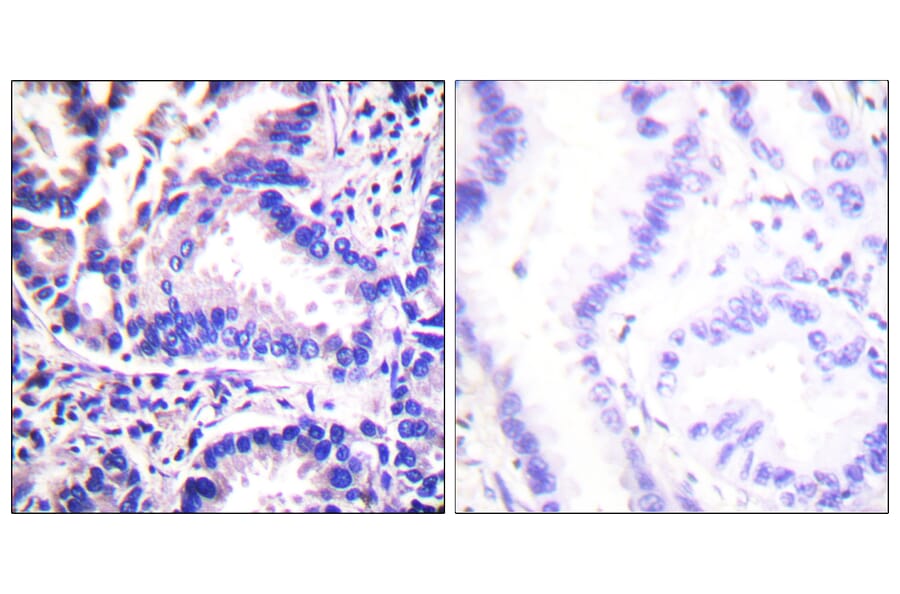 Immunohistochemistry - Anti-Synuclein gamma Antibody (C0334) - Antibodies.com