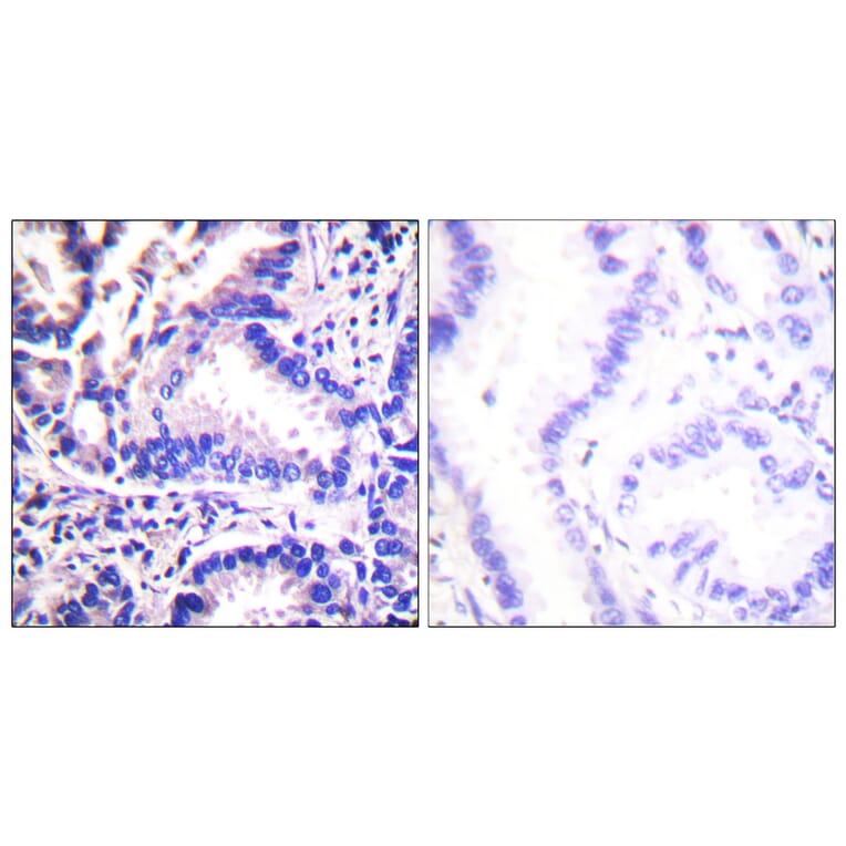 Immunohistochemistry - Anti-Synuclein gamma Antibody (C0334) - Antibodies.com