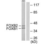 Western Blot - Anti-FOXB1 + FOXB2 Antibody (C11579) - Antibodies.com