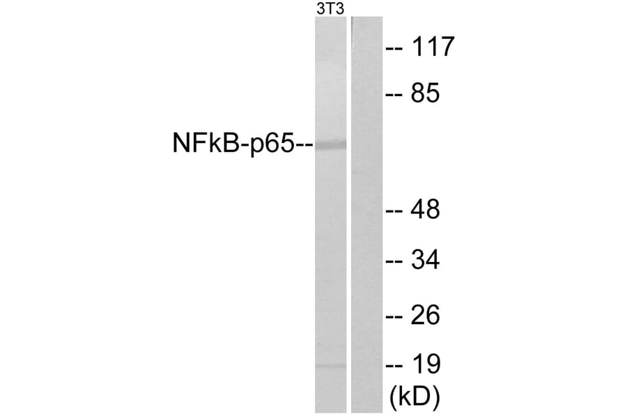 Western Blot - Anti-NF-kappaB p65 Antibody (B7163) - Antibodies.com