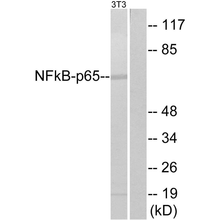 Western Blot - Anti-NF-kappaB p65 Antibody (B7163) - Antibodies.com