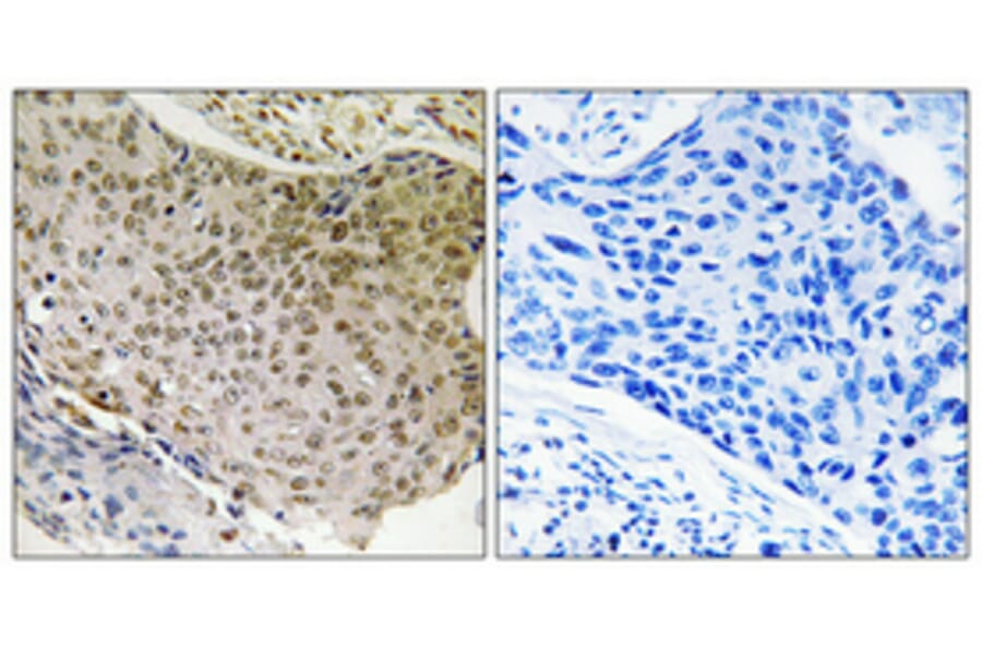 Immunohistochemistry - Anti-NF-kappaB p65 Antibody (B7163) - Antibodies.com