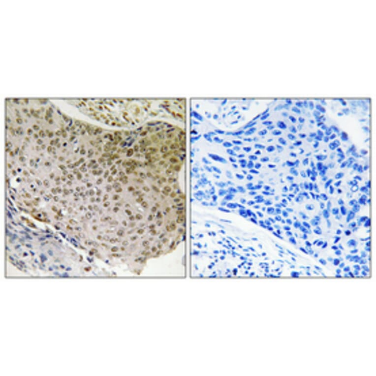 Immunohistochemistry - Anti-NF-kappaB p65 Antibody (B7163) - Antibodies.com
