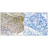 Immunohistochemistry - Anti-NF-kappaB p65 Antibody (B7163) - Antibodies.com