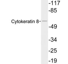 Western Blot - Anti-Cytokeratin 8 Antibody (R12-2108) - Antibodies.com