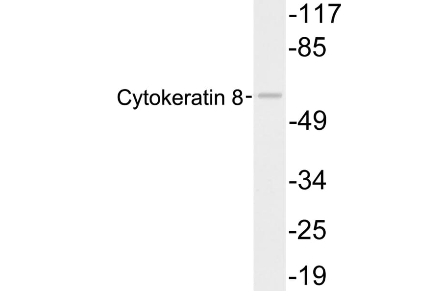 Western Blot - Anti-Cytokeratin 8 Antibody (R12-2108) - Antibodies.com