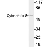 Western Blot - Anti-Cytokeratin 8 Antibody (R12-2108) - Antibodies.com