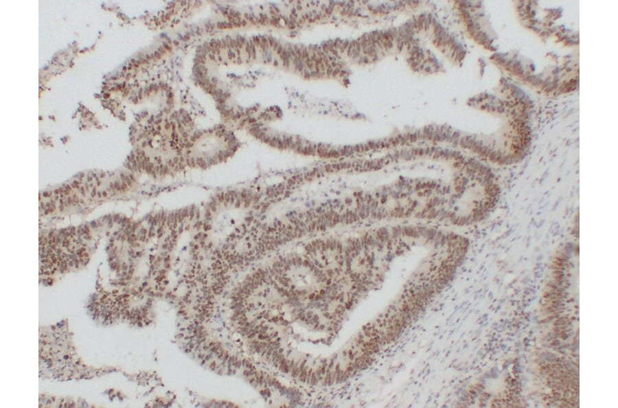 Immunohistochemistry - Anti-Nucleophosmin Antibody (V0104) - Antibodies.com