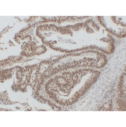 Immunohistochemistry - Anti-Nucleophosmin Antibody (V0104) - Antibodies.com